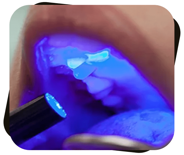 Oral Cancer Screenings at Dr. Jay Family Dental
